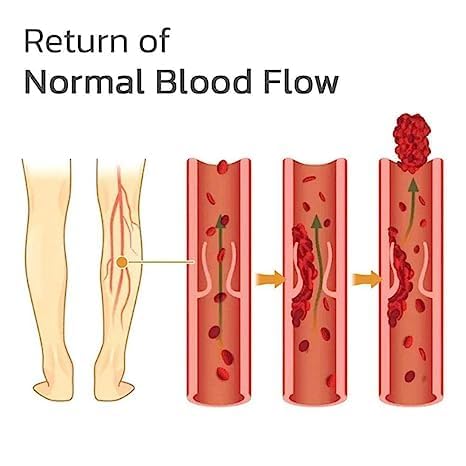 Turmeric Instant Relief Varicose Vein Patches(Buy 1 get 1 Free🔥)