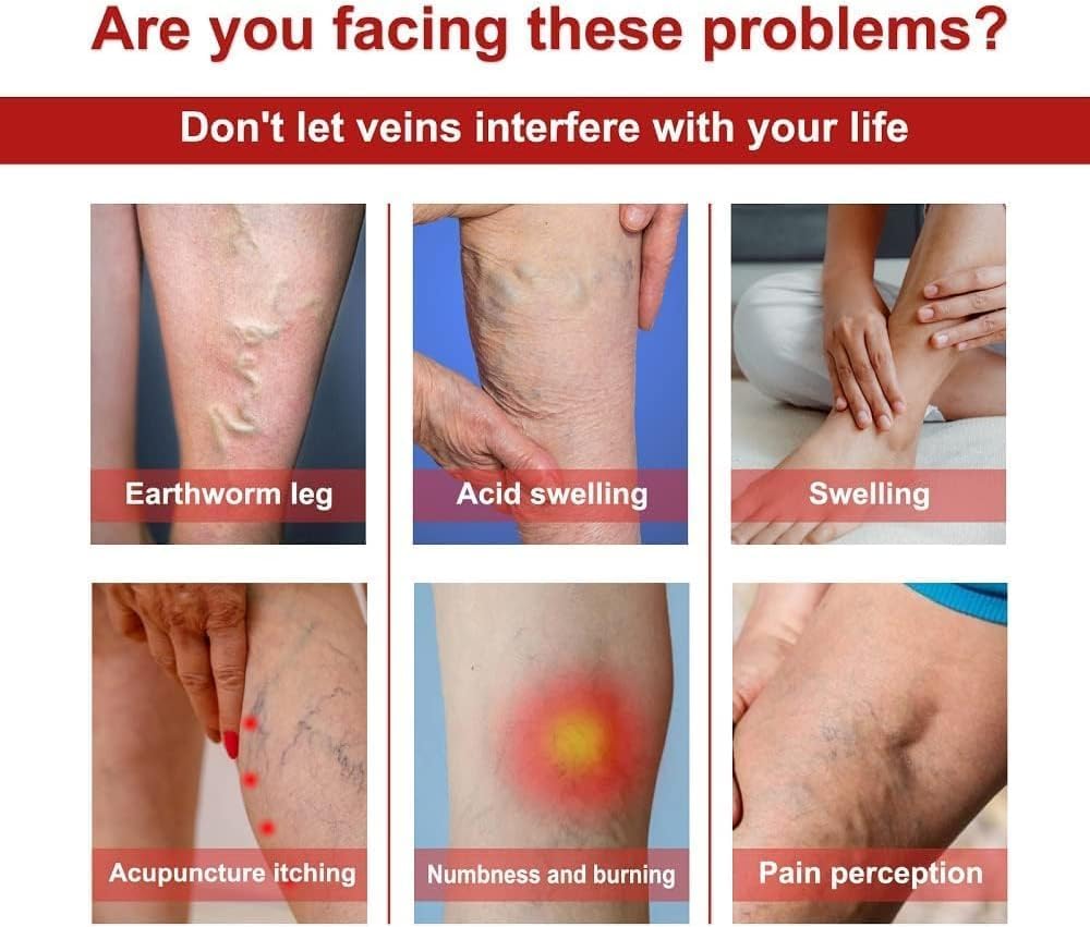 Turmeric Instant Relief Varicose Vein Patches(Buy 1 get 1 Free🔥)