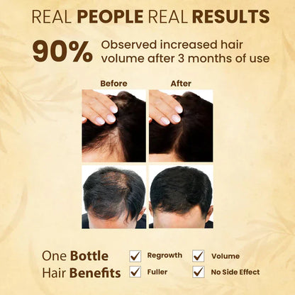 Jamalgota Powder for Hair Growth, Natural Skin & Hair Solution 🌱✨ (Buy 1 Get 1 Free🔥🔥)
